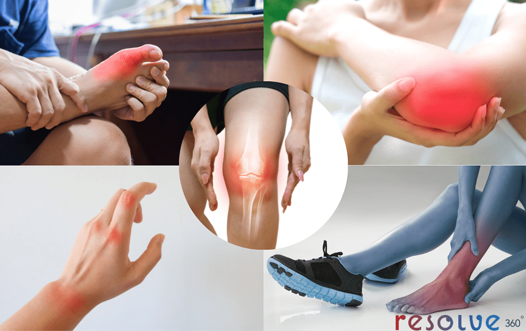 Causes of joint pain